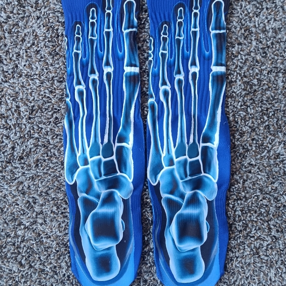 Kobe 5 Protro X Ray - Picture 3 of 3